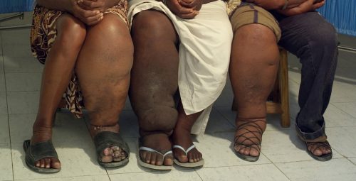 चैत २० गतेदेखि हात्तीपाइले रोगविरुद्धको औषधि खुवाइने