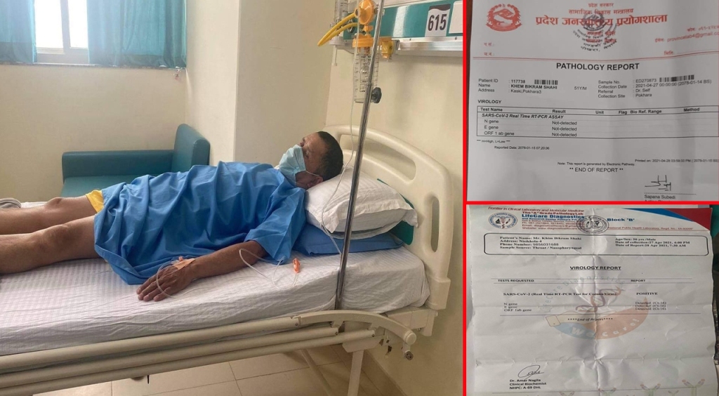 आईसियुमा उपचाररत सांसद शाही विरामी कि बहाना ? कोराेना रिपोर्ट नै शंकास्पद