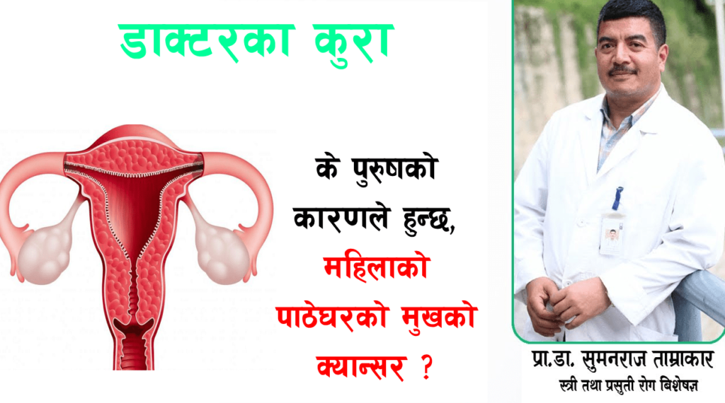 महिलामा पाठेघरको मुखको क्यान्सर हुनुमा पुरुषकाे दाेष कति ?