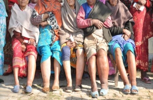 कास्कीमा हात्तीपाइले रोग निवारणका लागि टास थ्री सर्वेक्षण सञ्चालन