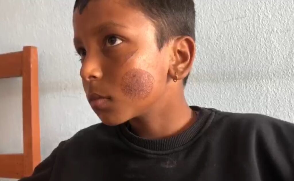 पन्युले डामेर विद्यार्थी घाइते बनाउने शिक्षिका पक्राउ