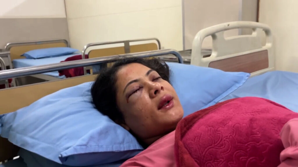 झडपमा घाइते पत्रकार कार्कीको तिलगंगा आँखा अस्पतालमा उपचार हुँदै