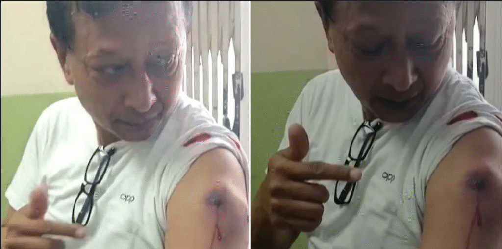 कान्तिपुर टिभीका पत्रकार श्रेष्ठलाई रबरको गोली लाग्यो