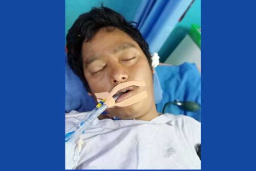 पोखरामा स्कुटरको ठक्करबाट एक पुरुष गम्भीर घाइते